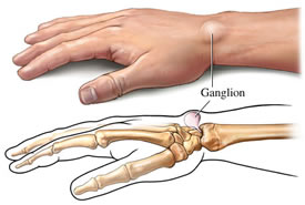 Ganglions Diagram