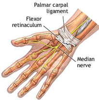 Picture of carpal tunnel